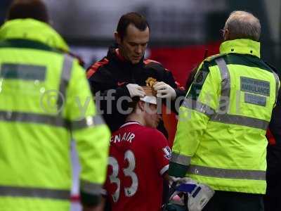 Yeovil Town v Manchester United 040115